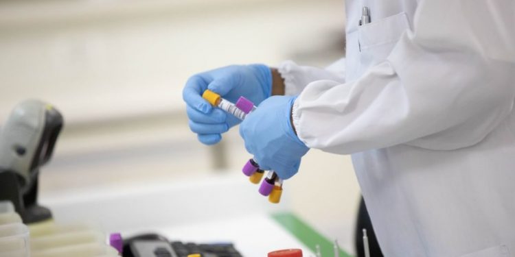 Covid-19: kits de testes rápidos são bloqueados pela China e não chegam a Cascavel