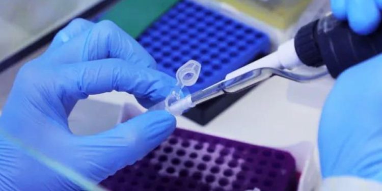 Foz do Iguaçu confirma primeiro caso de varíola dos macacos